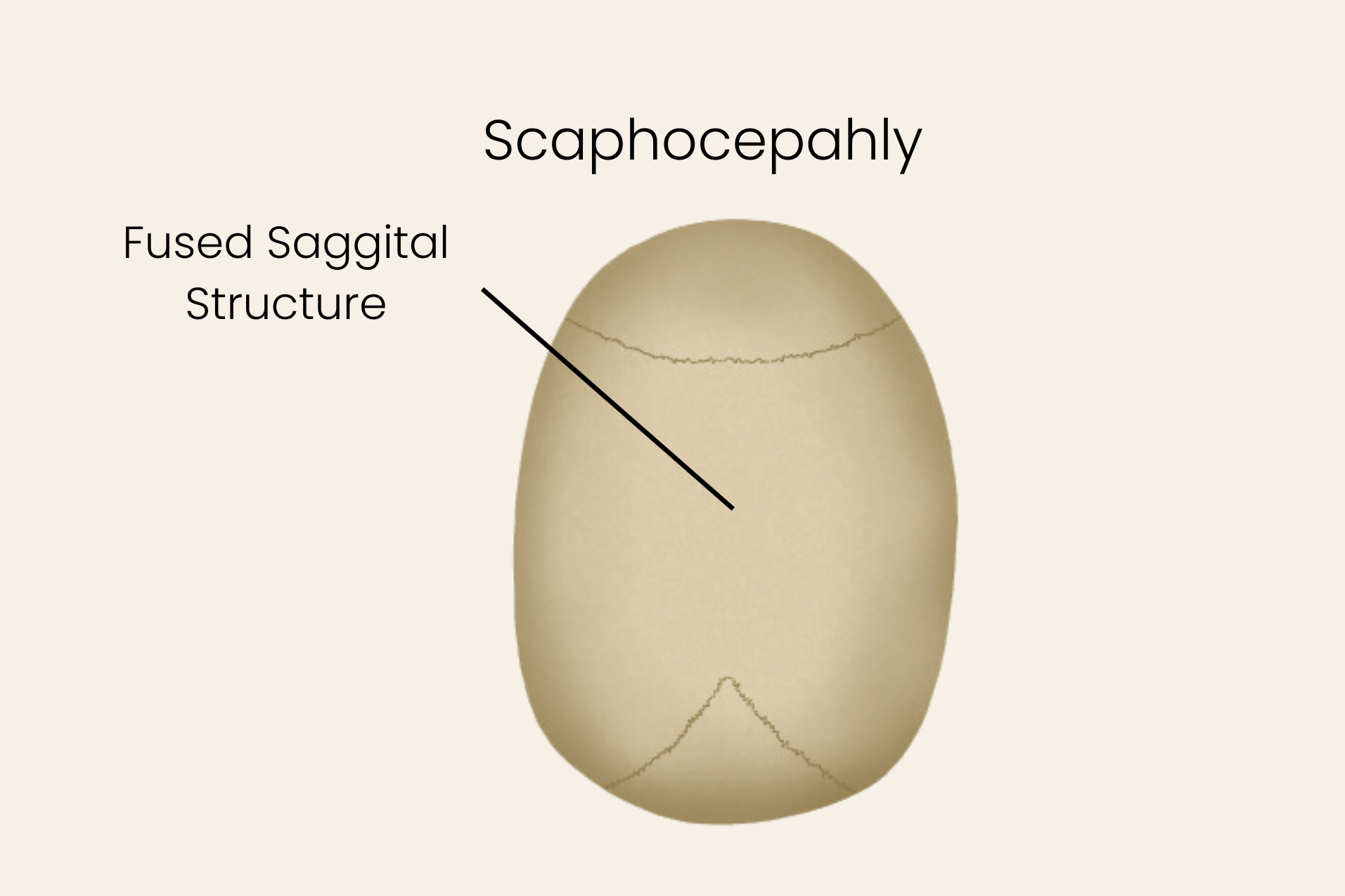  Photo credit:&nbsp; https://stanfordhealthcare.org/  